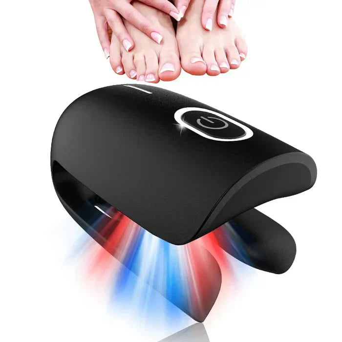Lasertherapiegerät gegen Nagelpilz – Starterset – Lamylie
