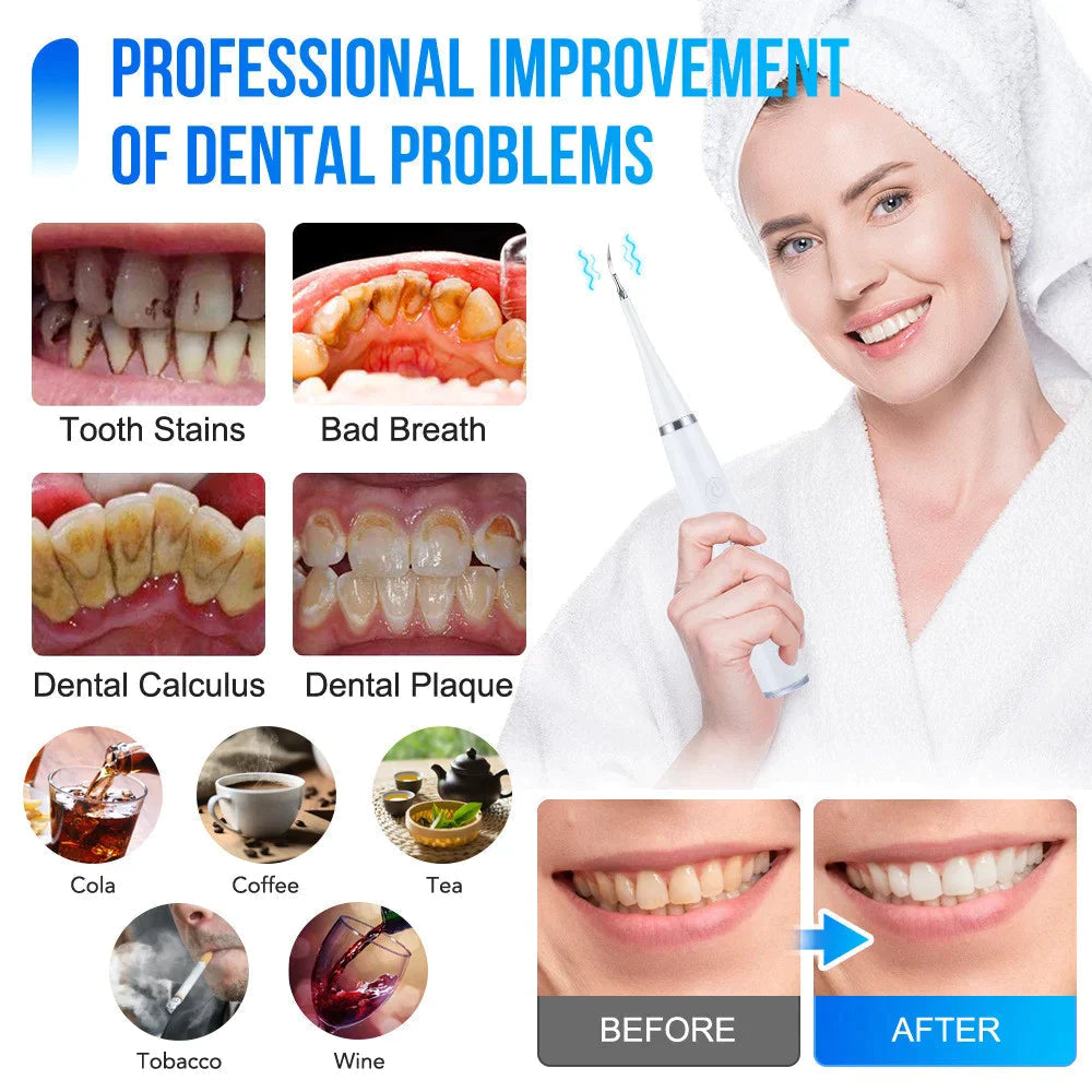 SmilePulse — Effortless Deep Cleaning for a Radiant, Confident Smile Every Day - Lamylie