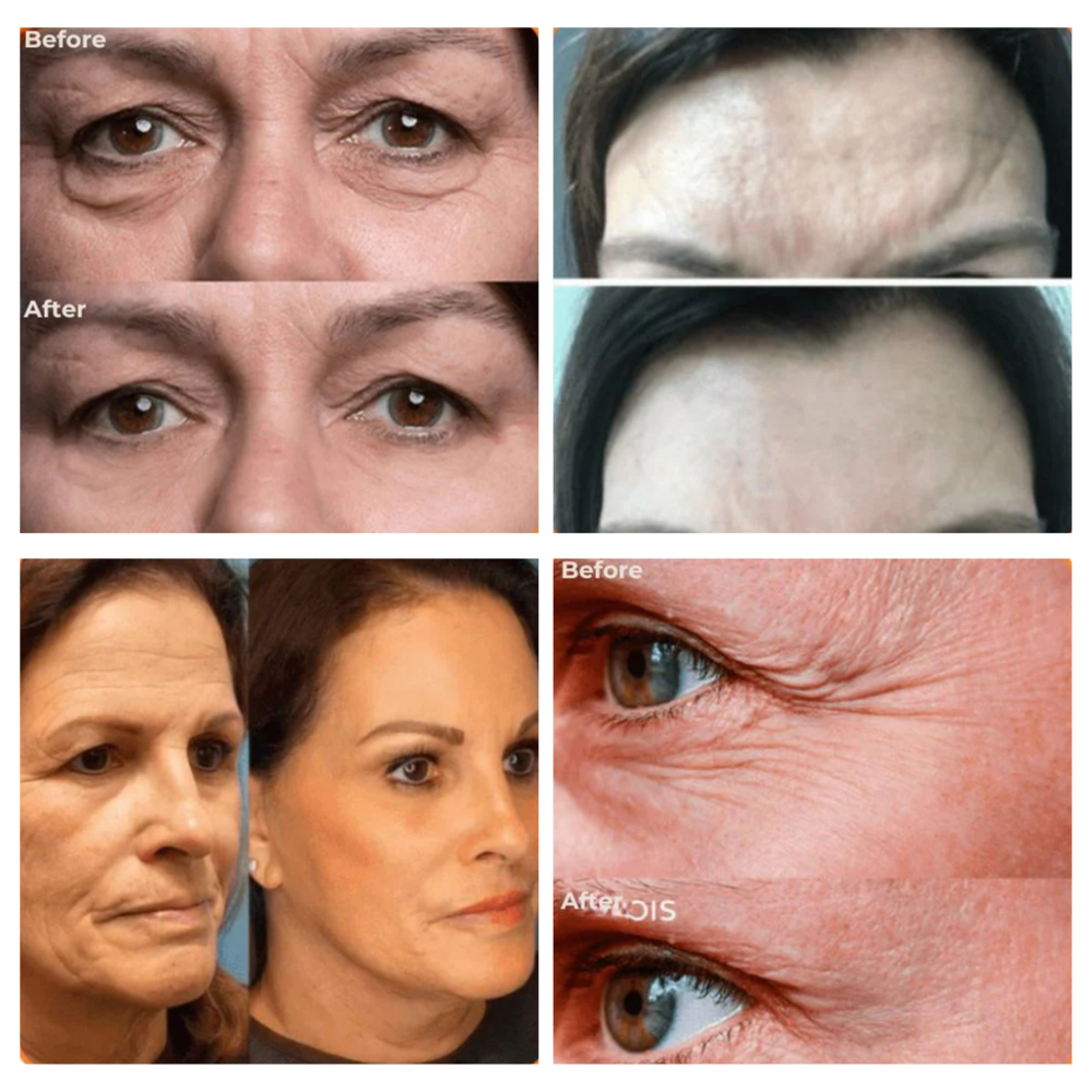 PerfectSync — Erase Fine Lines & Glow Naturally - Lamylie