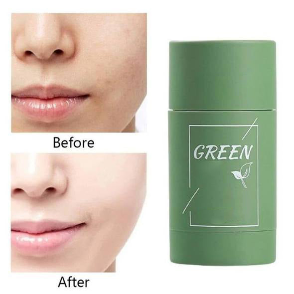 PurifyMist — Unleash Clear, Radiant Skin That Glows with Confidence - Lamylie