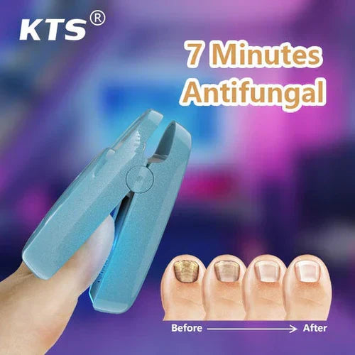 Appareil laser de traitement de la mycose des ongles pour l’onychomycose – Lamylie