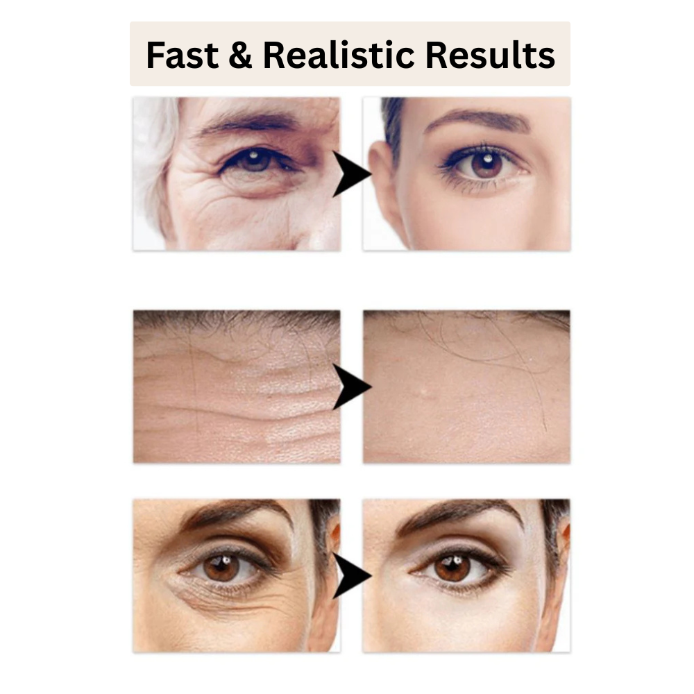 PerfectSync — Erase Fine Lines & Glow Naturally - Lamylie