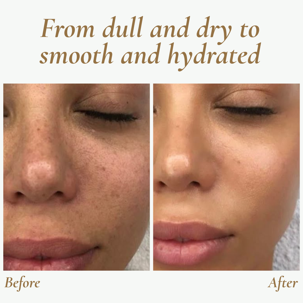 SkinPulse - Professional Ultrasonic Skin Cleansing - Lamylie