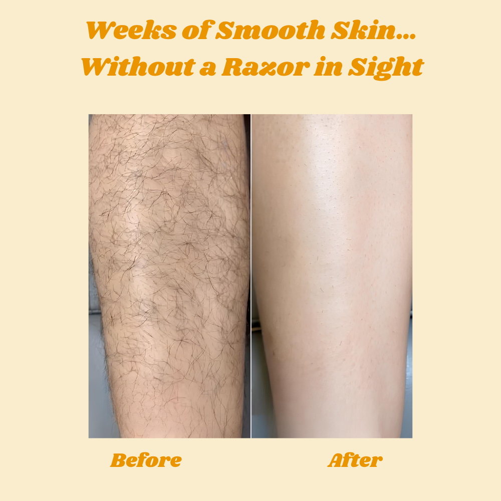 HoneyMousse — Experience Pain-Free, Irresistibly Smooth Skin That Lasts Weeks - Lamylie