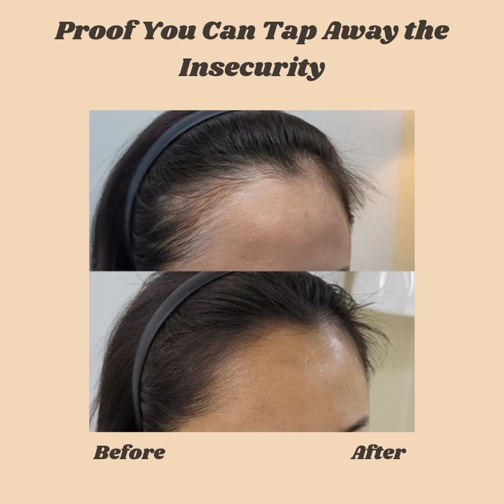 FolliBurst — Instantly Transform Thinning Hair into Full-Bodied Confidence - Lamylie