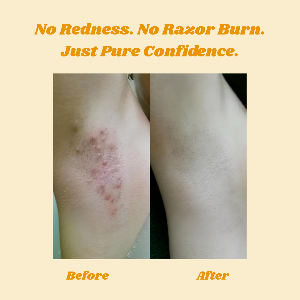 HoneyMousse — Experience Pain-Free, Irresistibly Smooth Skin That Lasts Weeks - Lamylie