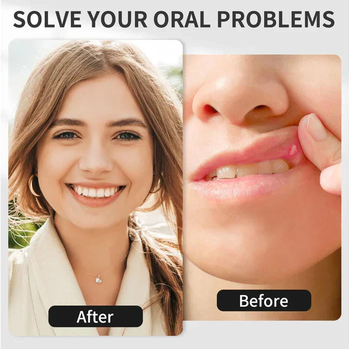 Red Light Therapy Device for Oral Care at Home - Lamylie
