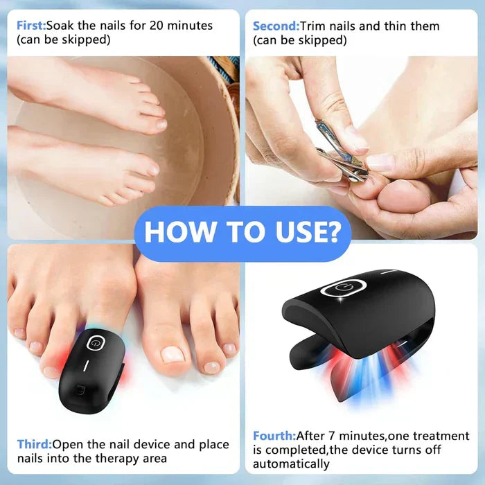 Onychomycosis Treatment Device for Nail Fungus Removal - Lamylie