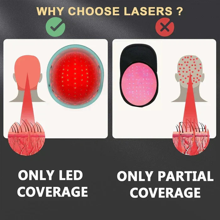 Laser Hair Growth Therapy System with Cap Device - Lamylie