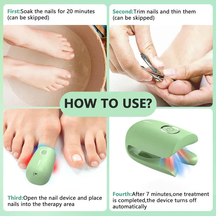 Onychomycosis Treatment Device for Nail Fungus Removal - Lamylie