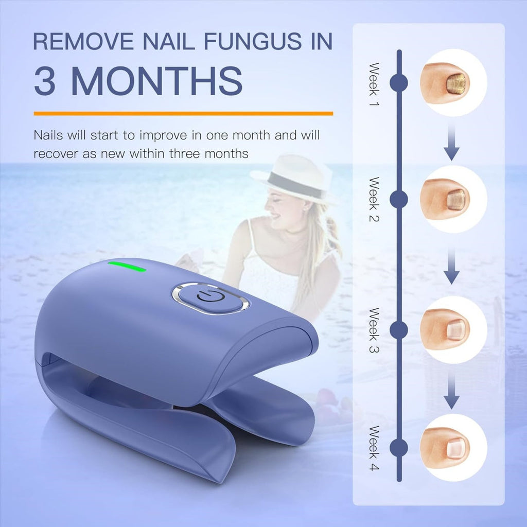Appareil de traitement des ongles atteints de mycose - Système de soin complet - Lamylie