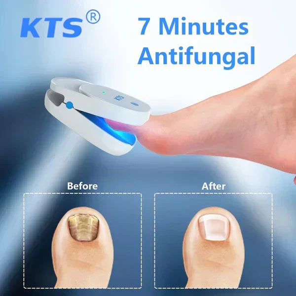Lasertherapiegerät gegen Nagelpilz – Starterset – Lamylie