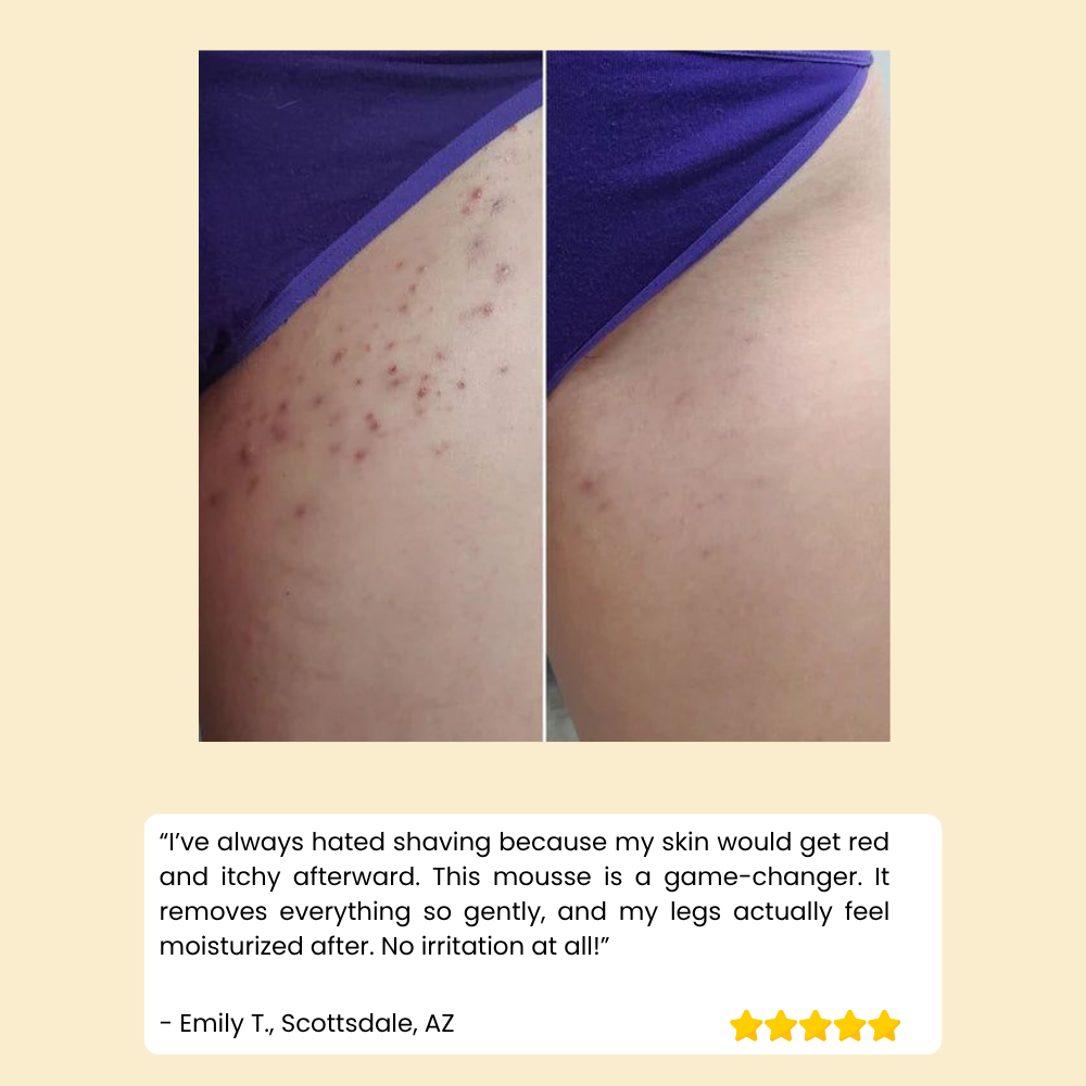 HoneyMousse — Experience Pain-Free, Irresistibly Smooth Skin That Lasts Weeks - Lamylie