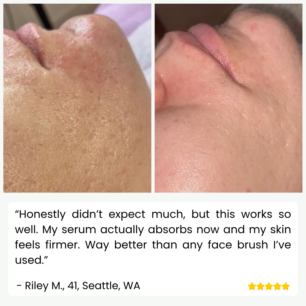 SkinPulse - Professional Ultrasonic Skin Cleansing - Lamylie