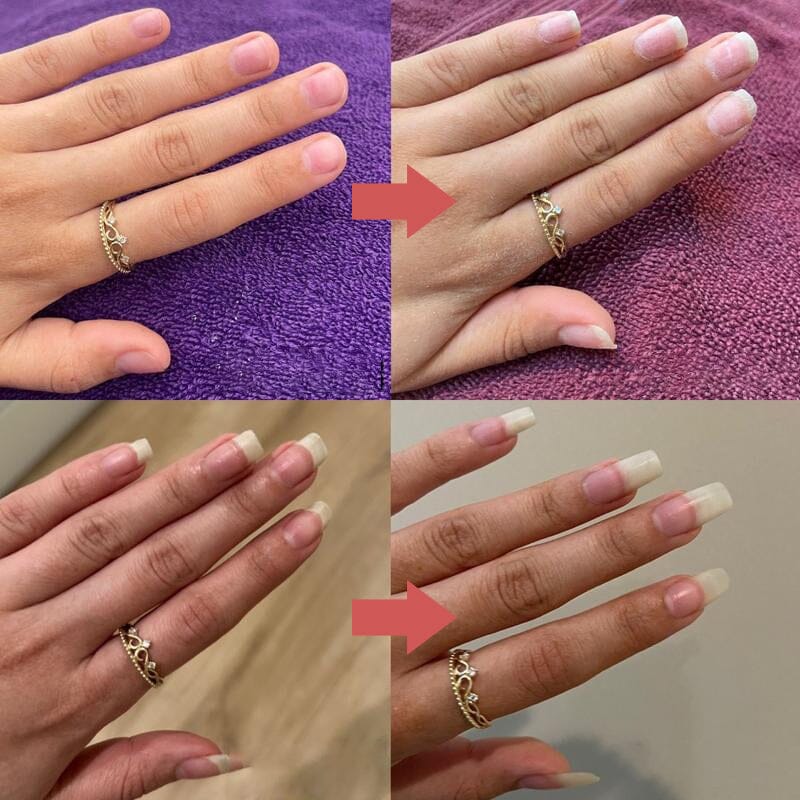 Seranail | Nail Nutrient-Rich Growth Oil - Lamylie