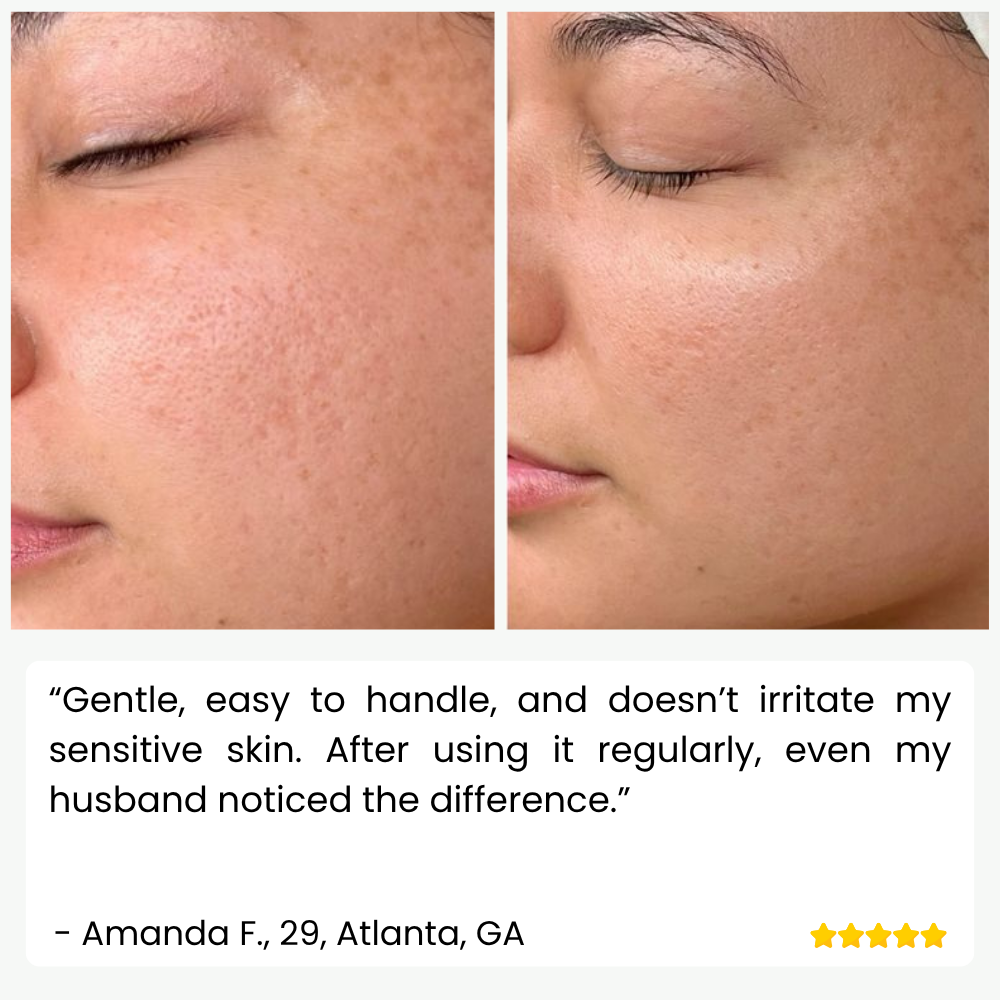 SkinPulse - Professional Ultrasonic Skin Cleansing - Lamylie