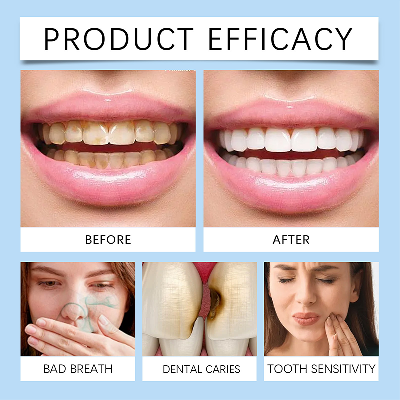 ShineGuard — Instant Enamel Strength & Sensitivity Relief for Unstoppable Smiles - Lamylie