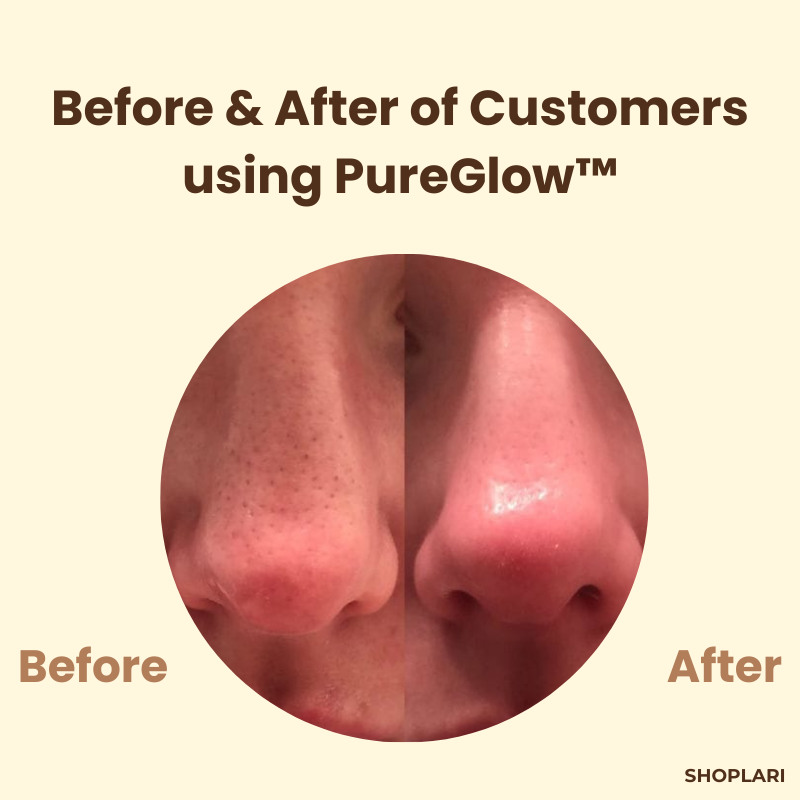 VeluxeTea — Unleash Radiant, Youthful Skin That Commands Admiration - Lamylie