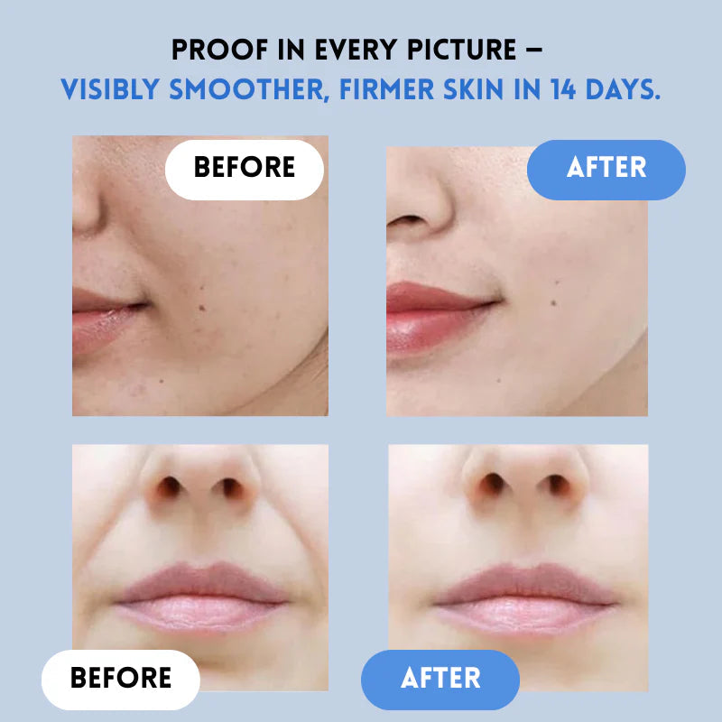 VivaLift — Instantly Transform Your Look with a Radiant, Youthful Glow - Lamylie