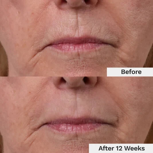 Luxevéria Youth-Restore Lippenfältchencreme – Lamylie