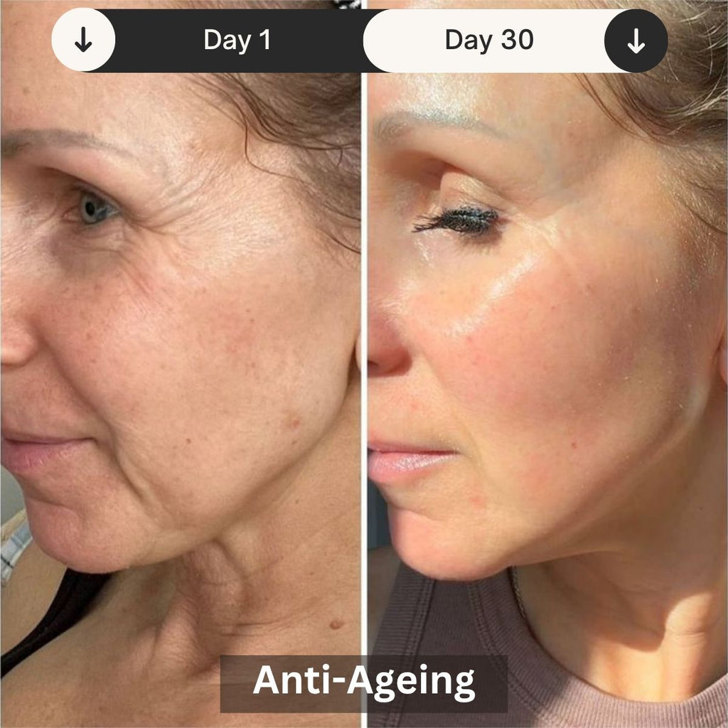 LED Skin Rejuvenation Therapy Device for Professional Use - Lamylie