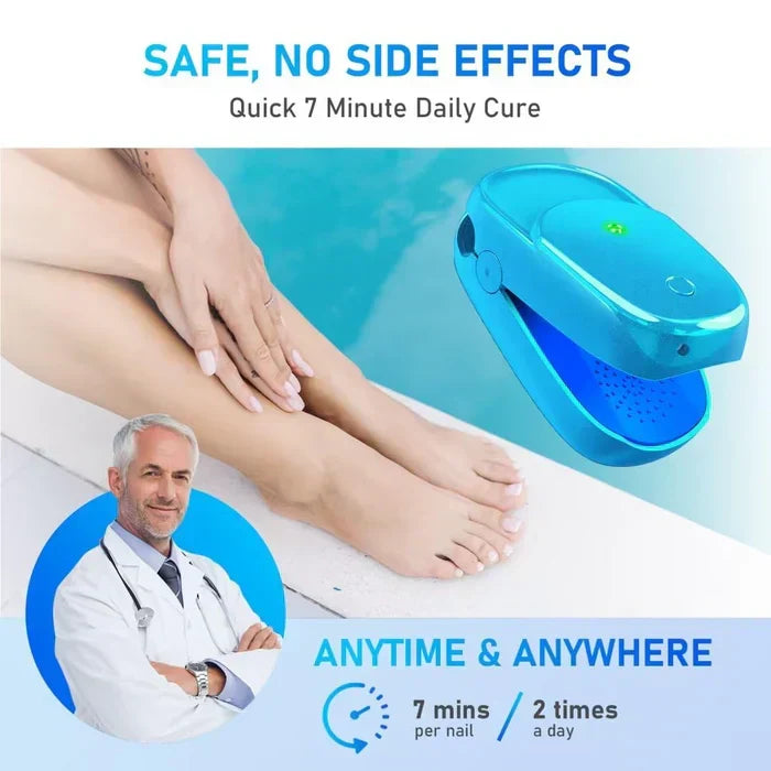 Appareil laser de traitement de la mycose des ongles pour l’onychomycose – Lamylie