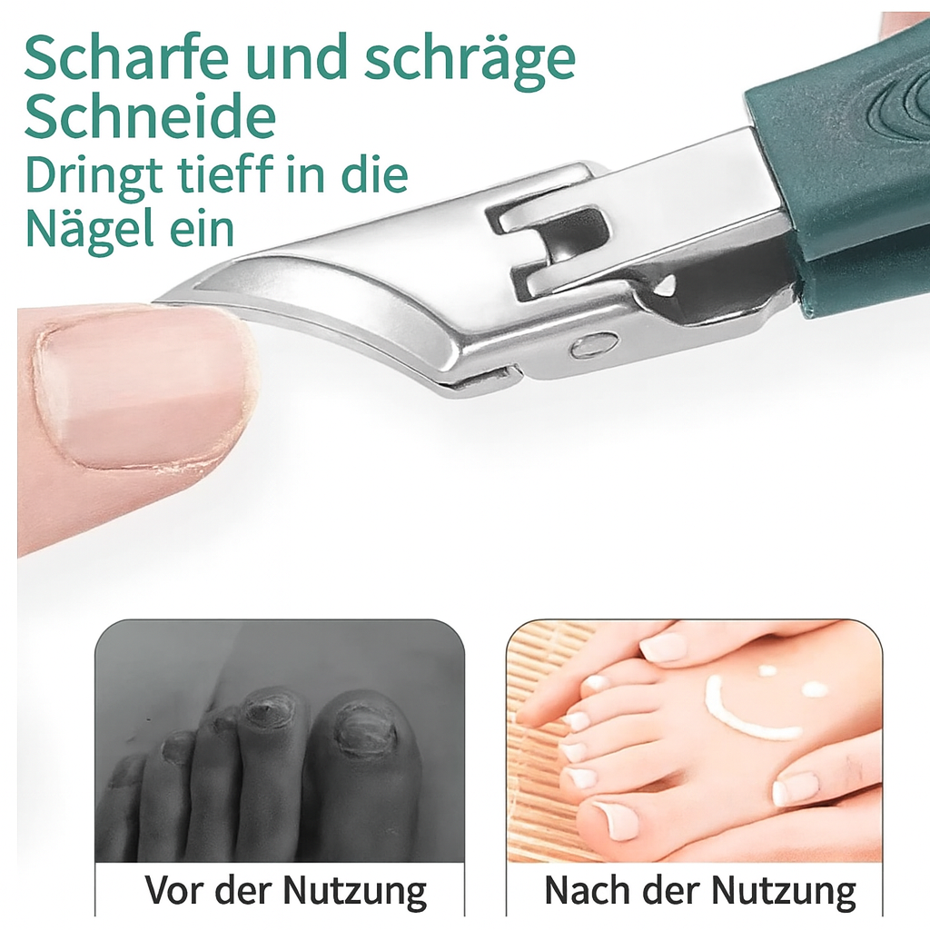 Nail Care Tool for Problematic Nails – Precision Trimmer - Lamylie