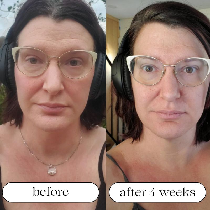 LED Light Therapy Device for At-Home Skin Treatment - Lamylie