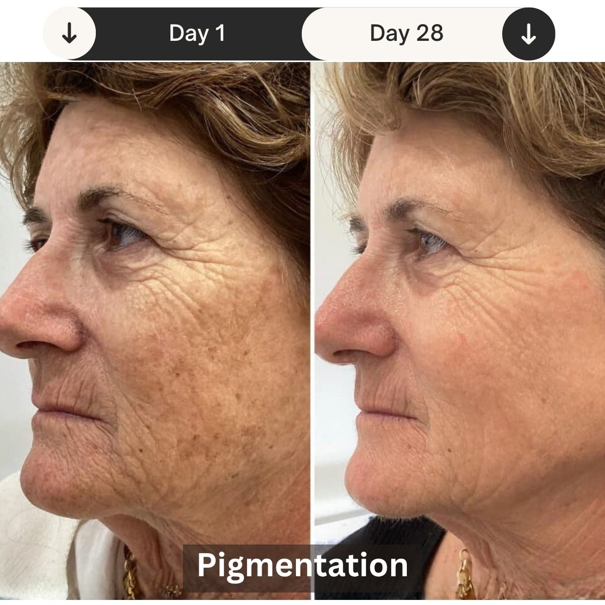 LED Skin Rejuvenation Therapy Device for Professional Use - Lamylie
