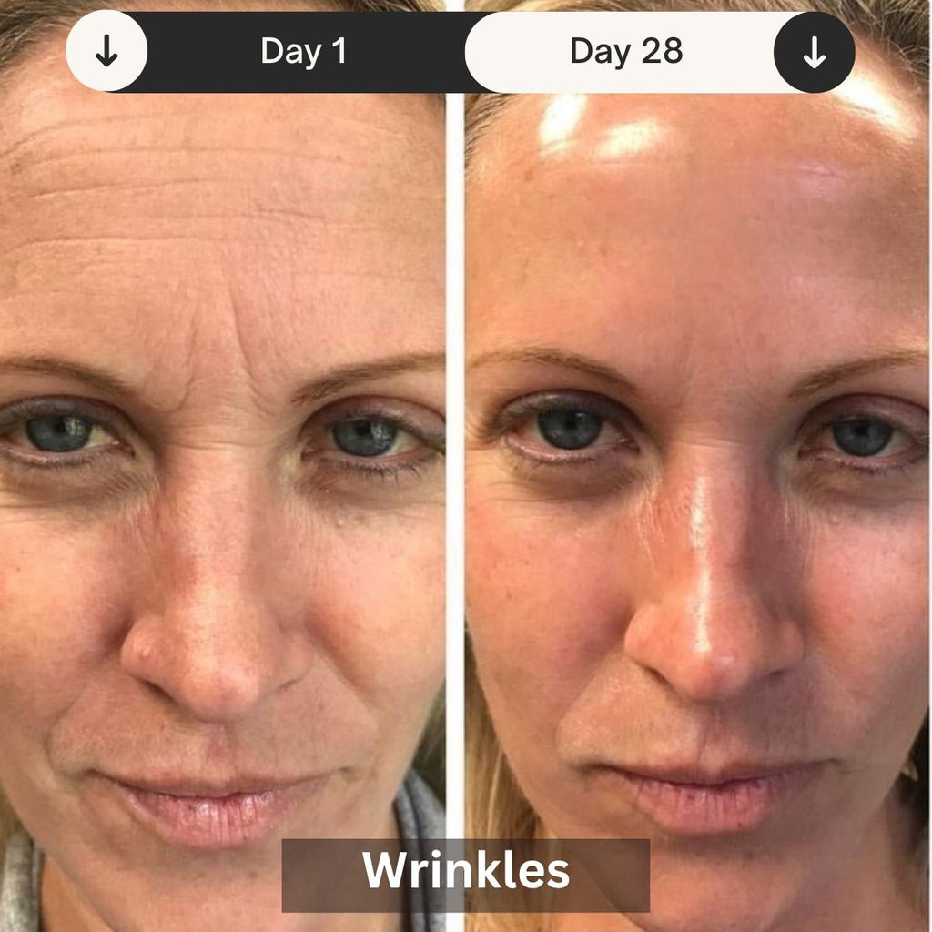 LED Skin Rejuvenation Therapy Device for Professional Use - Lamylie
