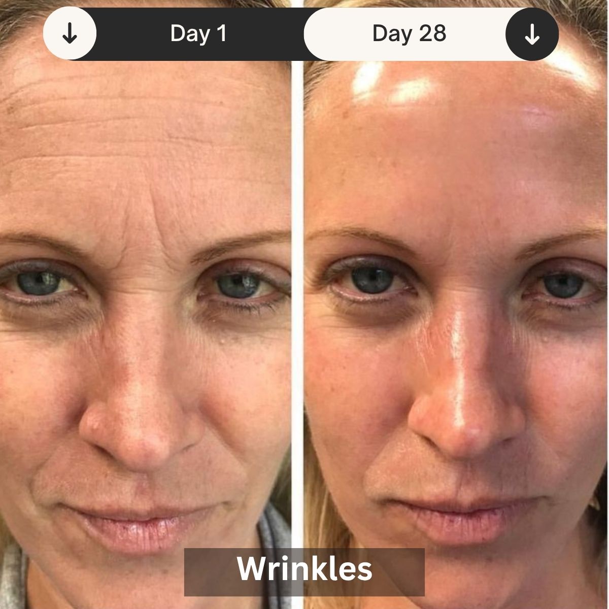 LED Skin Rejuvenation Therapy Device for Professional Use - Lamylie