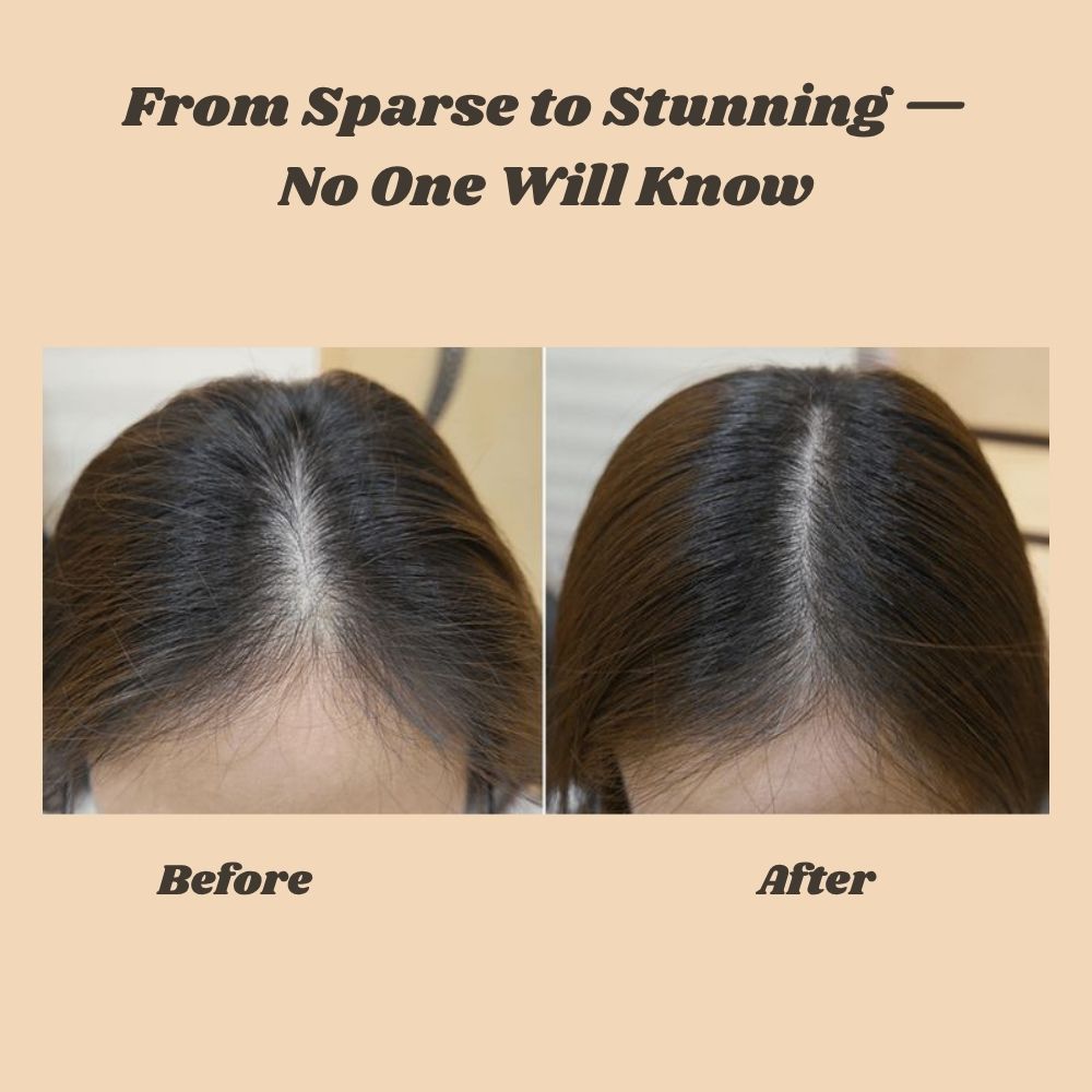 FolliBurst — Instantly Transform Thinning Hair into Full-Bodied Confidence - Lamylie