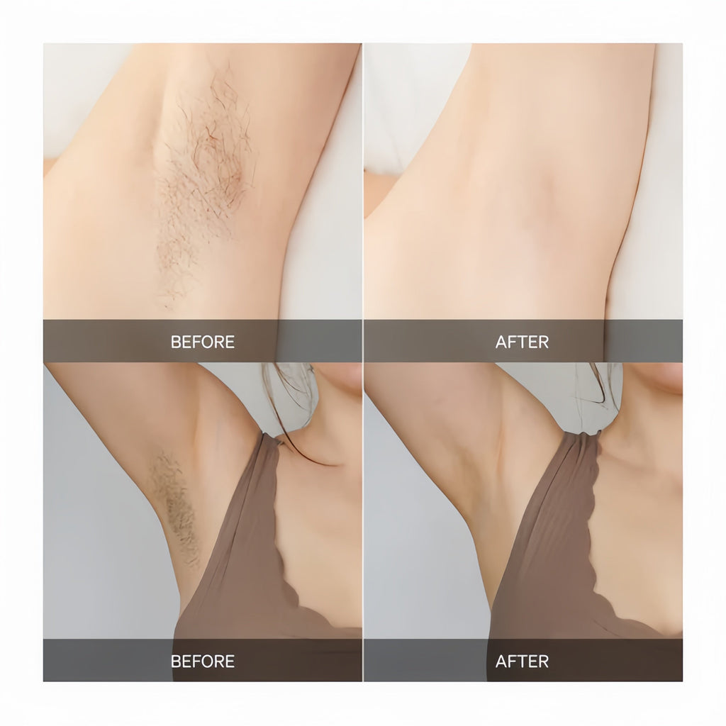 LumaSilk — Pain-Free, All-Over Smoothness That Fuels Your Confidence - Lamylie