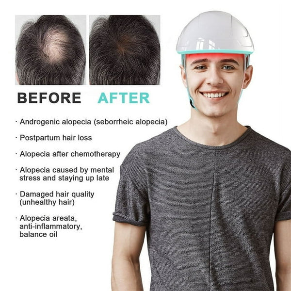 Laser Hair Growth Therapy System with Cap Device - Lamylie
