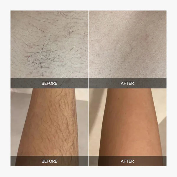 LumaSilk — Pain-Free, All-Over Smoothness That Fuels Your Confidence - Lamylie
