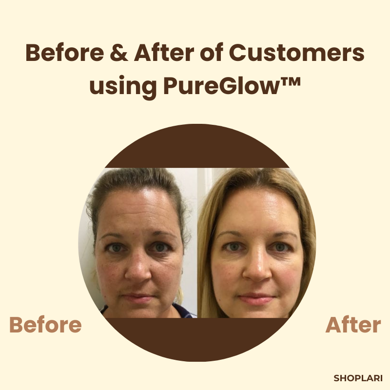 VeluxeTea — Unleash Radiant, Youthful Skin That Commands Admiration - Lamylie