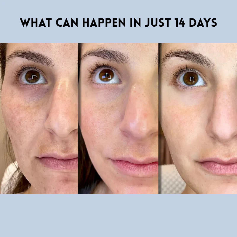 VivaLift — Instantly Transform Your Look with a Radiant, Youthful Glow - Lamylie