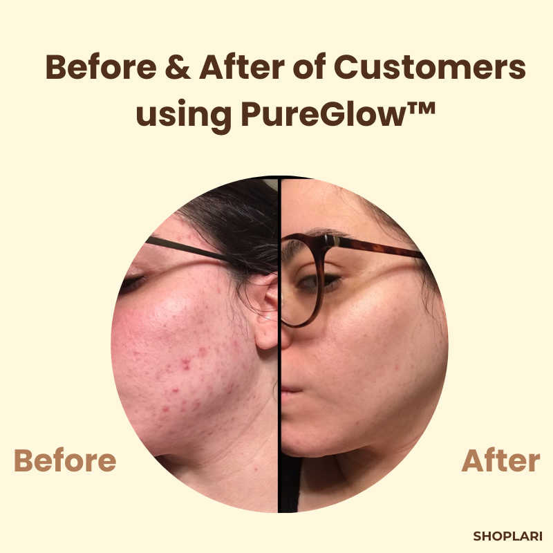 VeluxeTea — Unleash Radiant, Youthful Skin That Commands Admiration - Lamylie