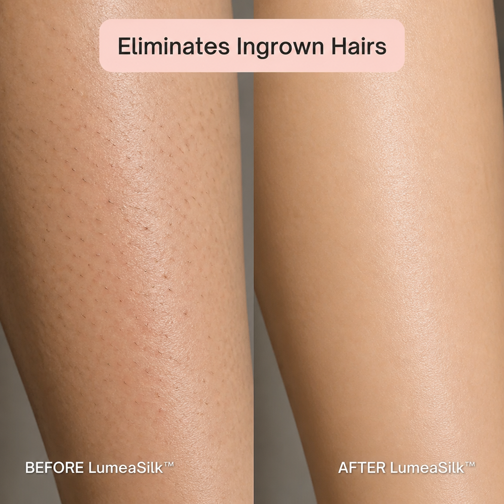 LumeaSilk — Shave the Bikini Line Without Nicks, Burns, or Ingrown Hairs - Lamylie