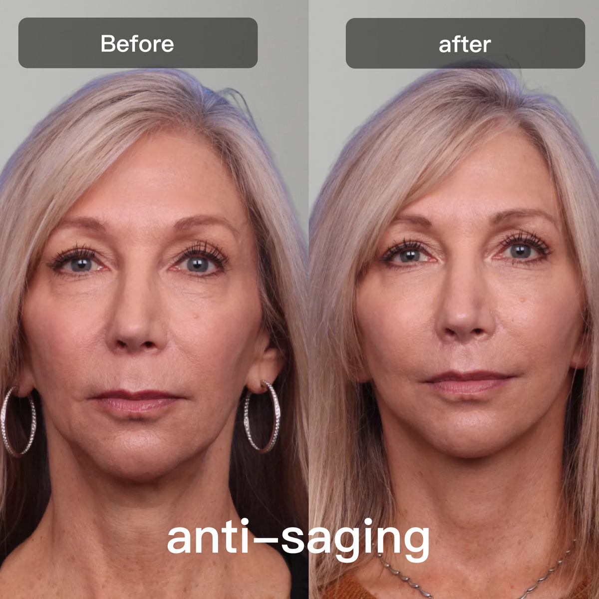 Light Therapy Device for Skin Care on Face and Body - Lamylie