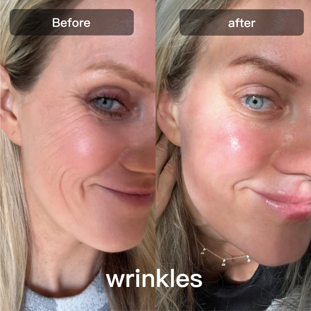 Light Therapy Device for Skin Care on Face and Body - Lamylie