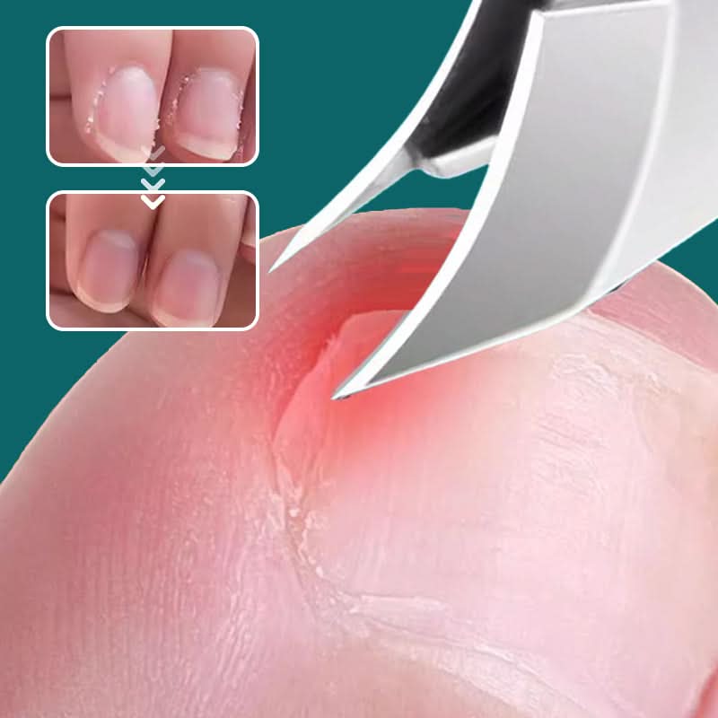 Nail Care Solution – Tidy Nails Without the Mess - Lamylie